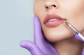 A medical professional in purple gloves performing a lip filler injection on a patient's upper lip with a precision needle