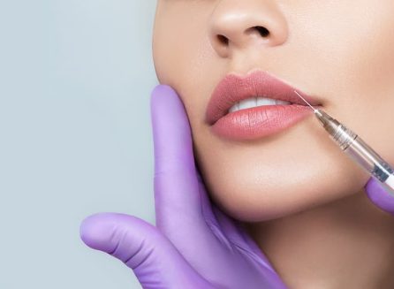 A medical professional in purple gloves performing a lip filler injection on a patient's upper lip with a precision needle