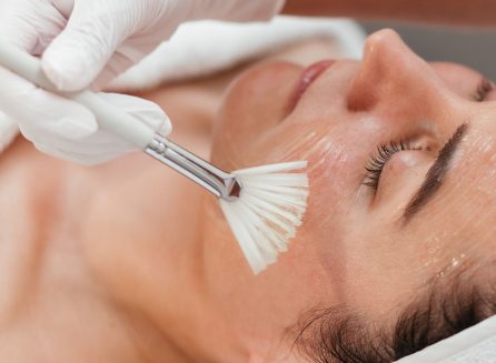 esthetician applying chemical peel solution to womans face during spa treatment